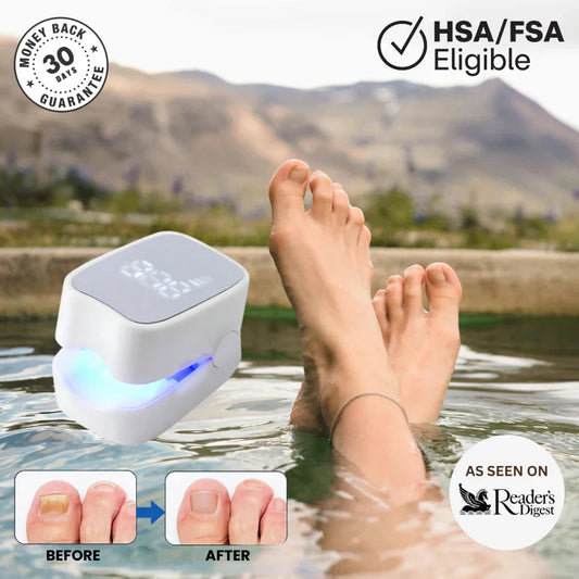 Vindora™ - Nail Fungus Laser Device